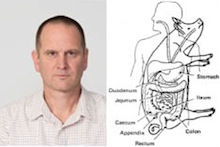 Brian Kerr with graphic of human gastric system
